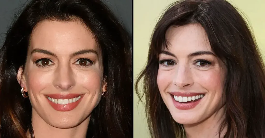 Anne Hathaway Has Asked People To Stop Calling Her ‘Anne’